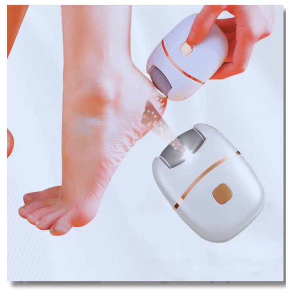 Electric Foot Callus Remover