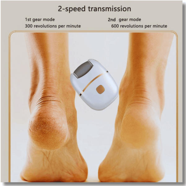 Electric Foot Callus Remover