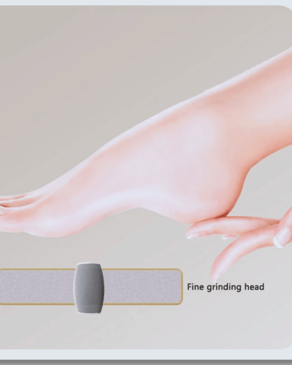 Electric Foot Callus Remover